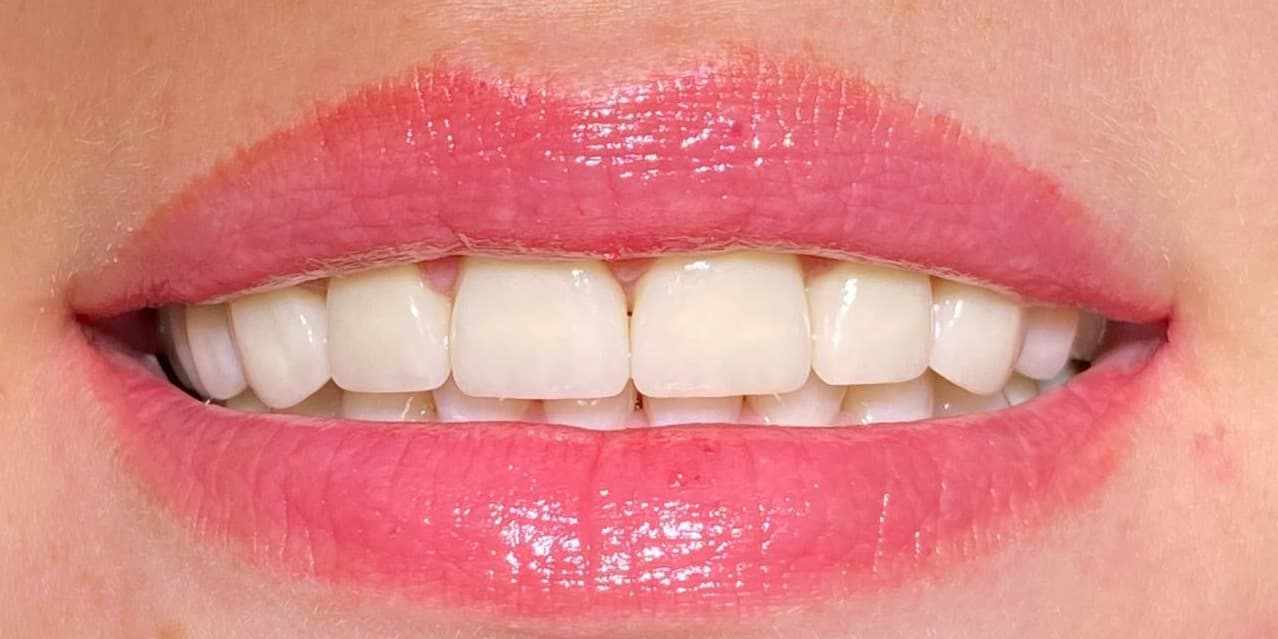 مراقبت از لثه، موارد طلایی و کاربردی