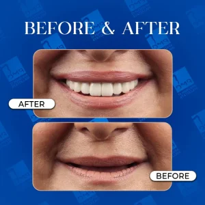 دندان مصنوعی5